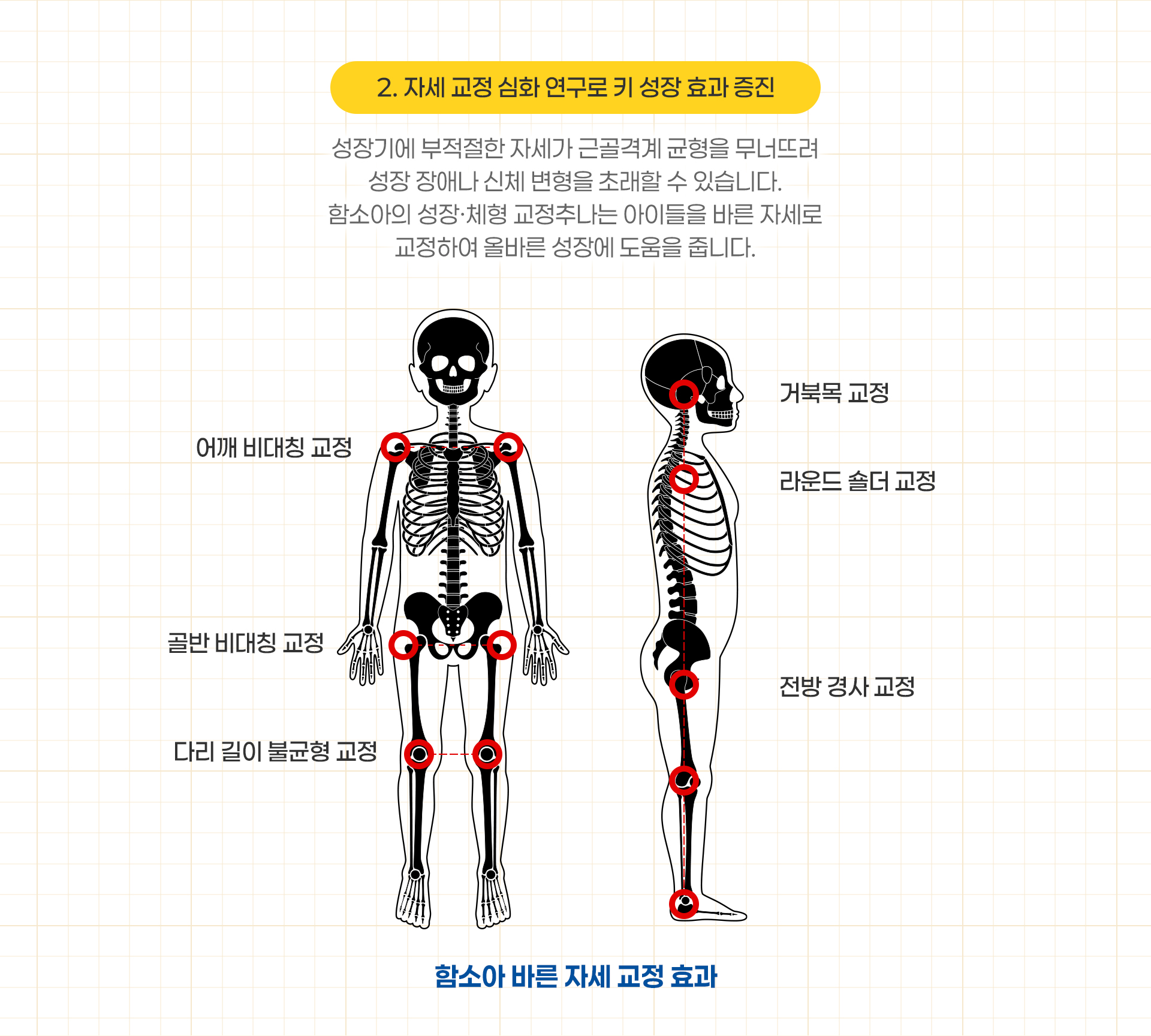 2.자세 교정 심화 연구로 키 성장 효과 증진