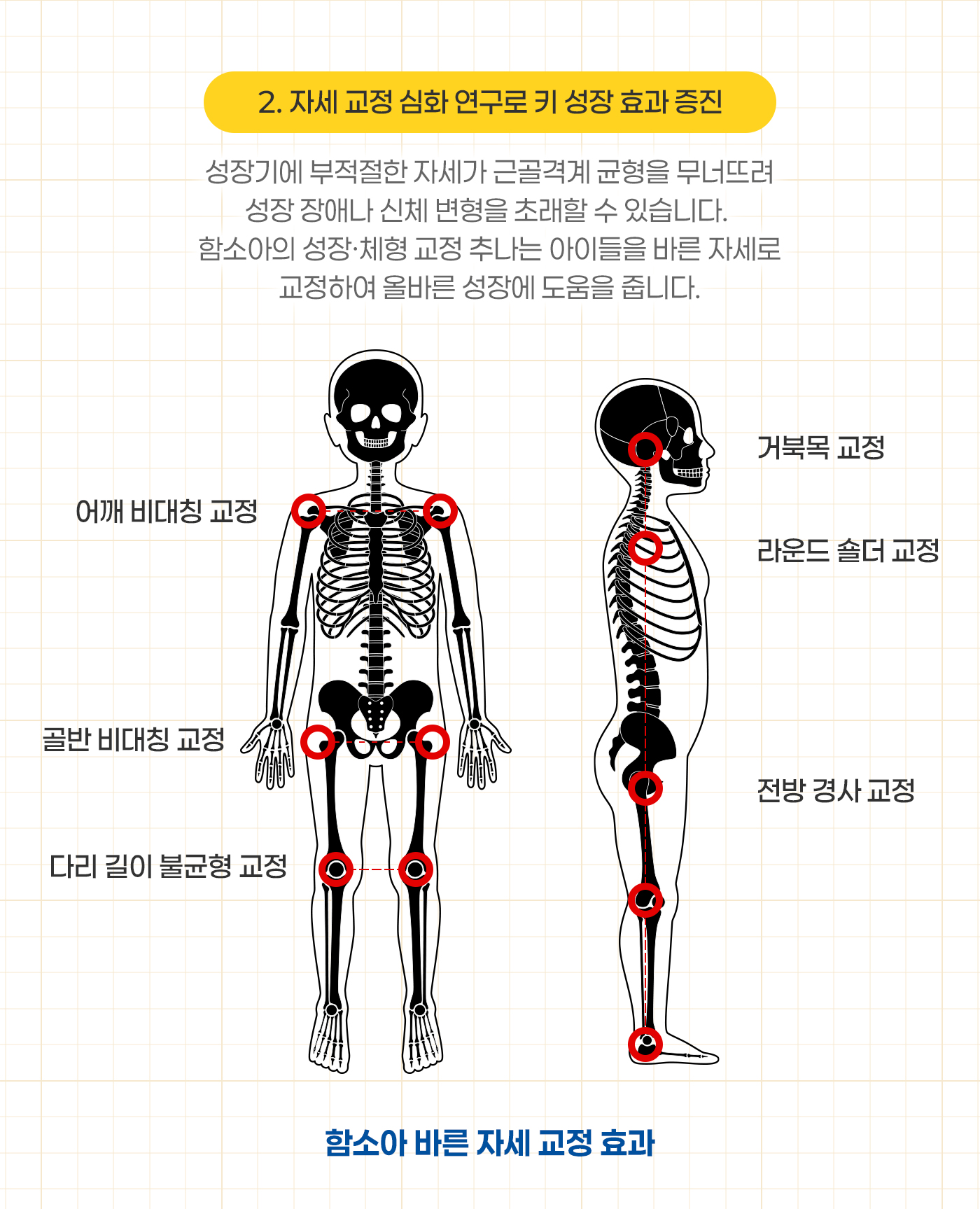 2.자세 교정 심화 연구로 키 성장 효과 증진